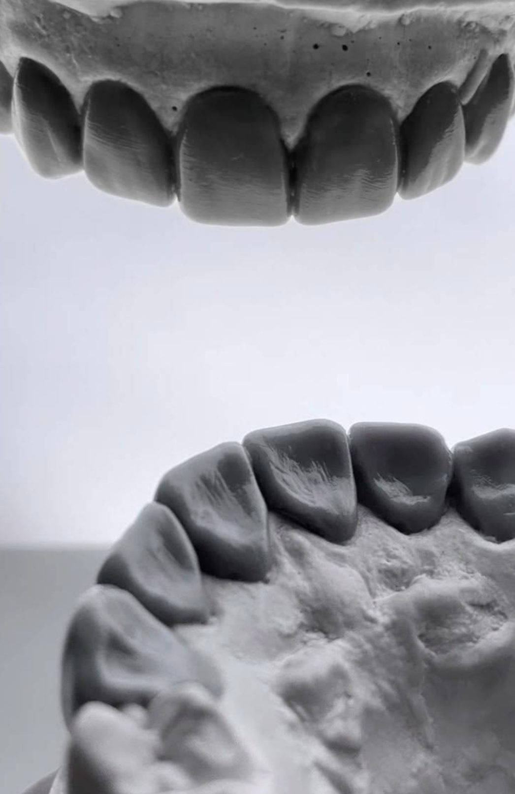 Diseño de sonrisa y estética dental